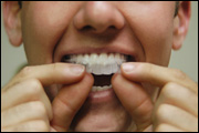 Custom teeth whitening tray